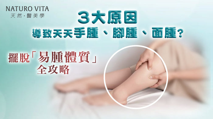 「你中招了嗎？告別易腫體質！3大原因＋保健品選擇全攻略」